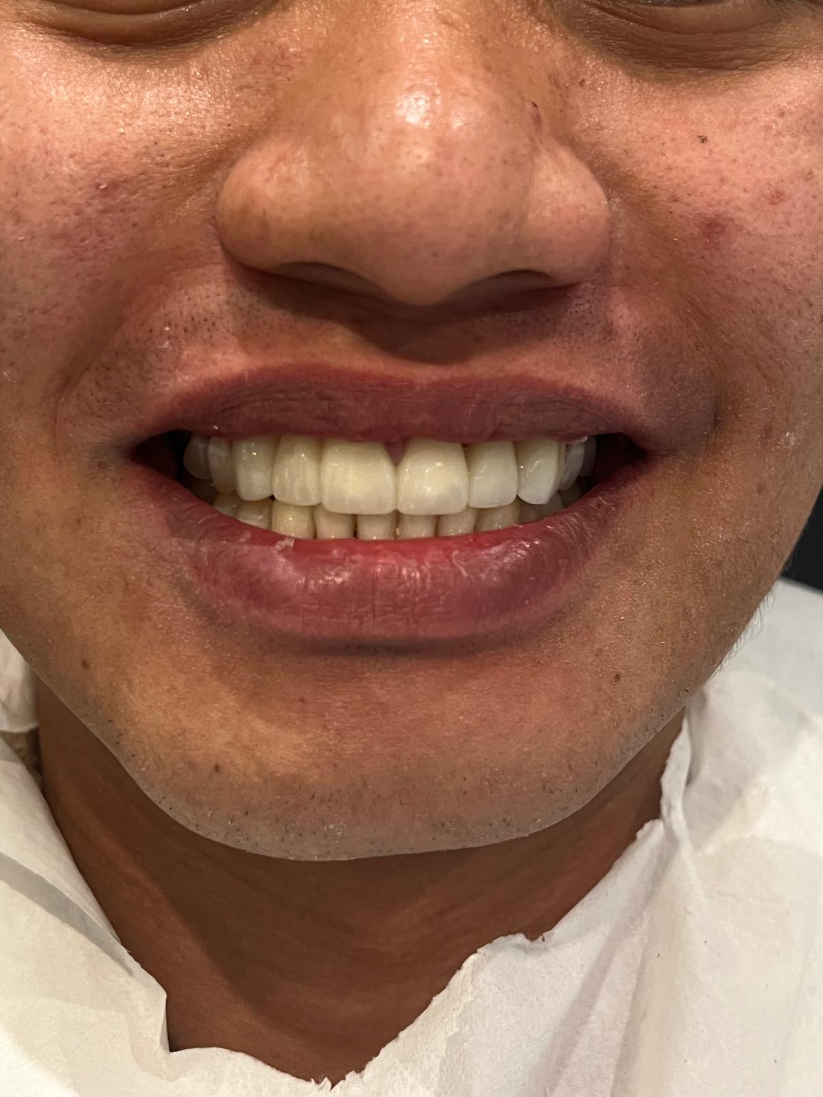 ECE Dental Patient Transformation